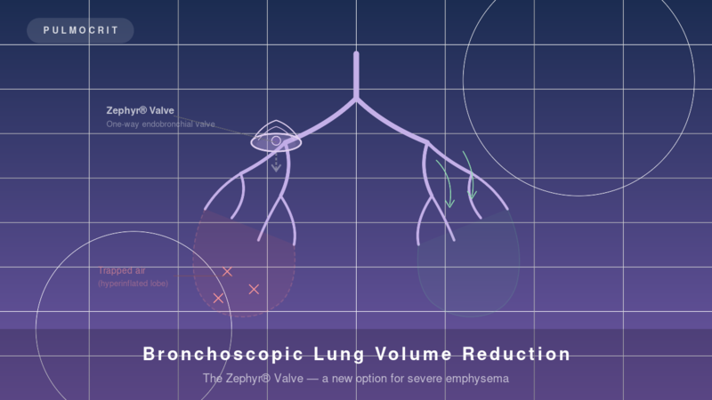 Bronchoscopic Lung Volume Reduction BLVR Zephyr Valve emphysema